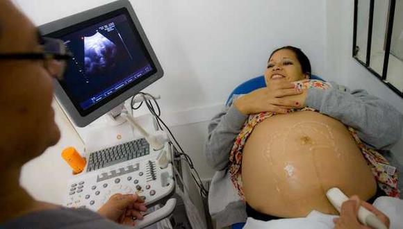 Durante la pandemia (2020 y 2021), se produjo un incremento de muertes maternas en Perú por causa de COVID-19. (Foto: Minsa)